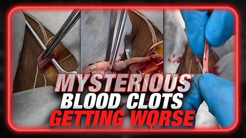 Funeral Home Director Warns Mysterious Blood Clots Getting Worse 1 Funeral Home Direc